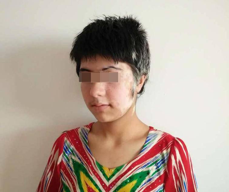 白殿瘋最新治療方法，變化帶來自信，重塑未來勵志之路